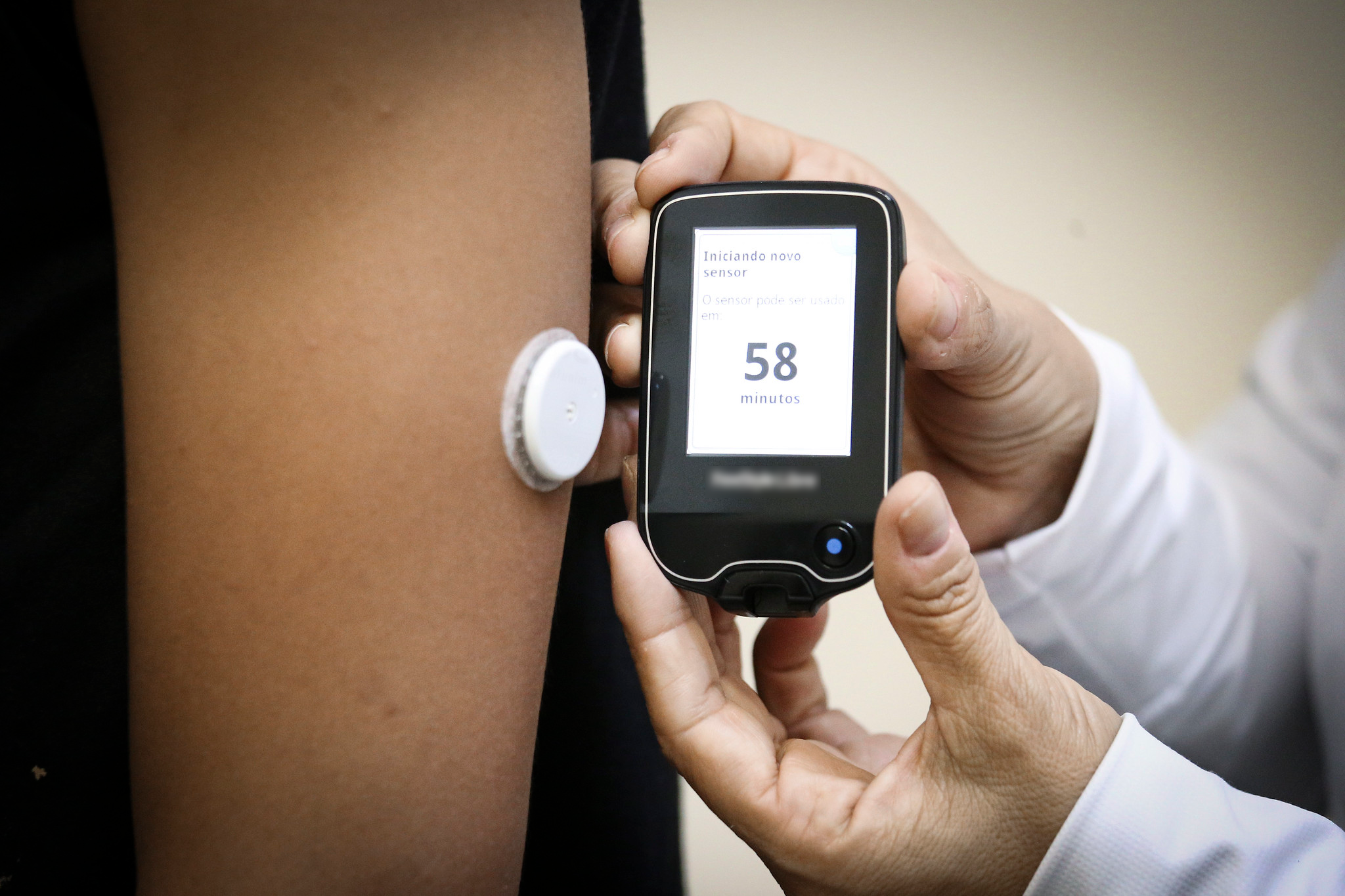 GDF investirá R$ 7,2 milhões em novos sensores de monitoramento de glicose para pacientes diabéticos